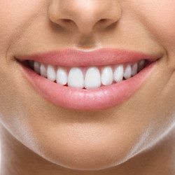 Smile Makeover Chevy Chase MD