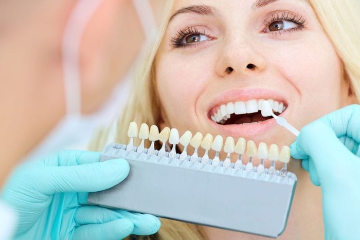 porcelain veneers cosmetic treatment in Chevy Chase Maryland