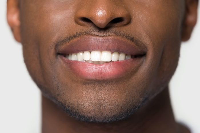 professional teeth whitening in Chevy Chase Maryland