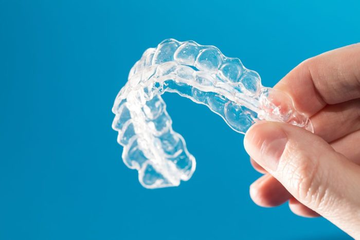 invisalign benefits Chevy Chase Maryland