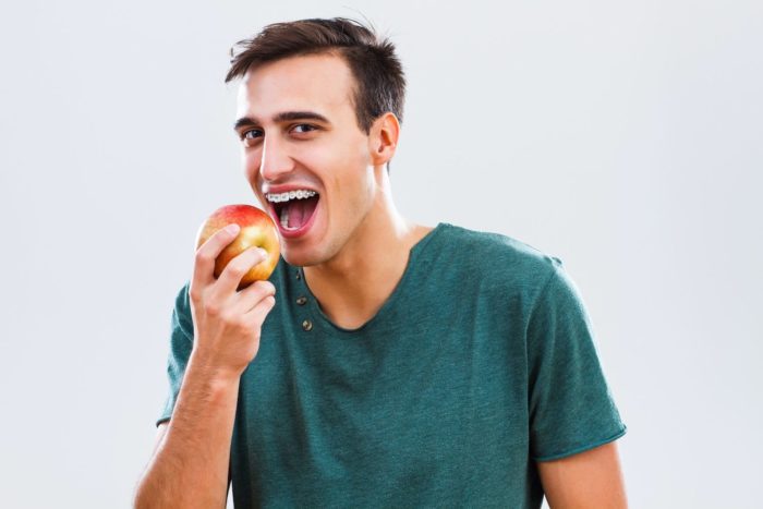 Young man with braces eating apple healthy snacks general dentistry dentist in Chevy Chase Maryland